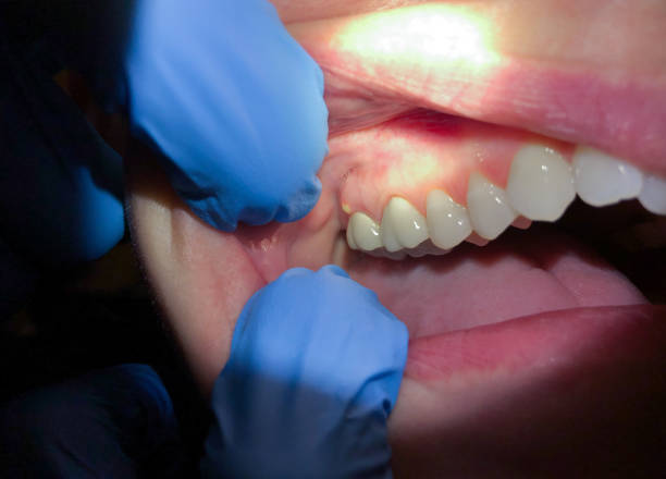 Best Emergency Dentist for Knocked-Out Tooth in Green Valley, SD