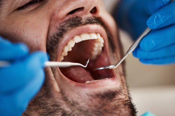 Best Emergency Dental Care for Abscessed Tooth in Green Valley, SD